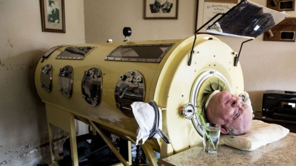 Vdes njeriu që jetoi 70 vjet në mushkëri të hekurt!