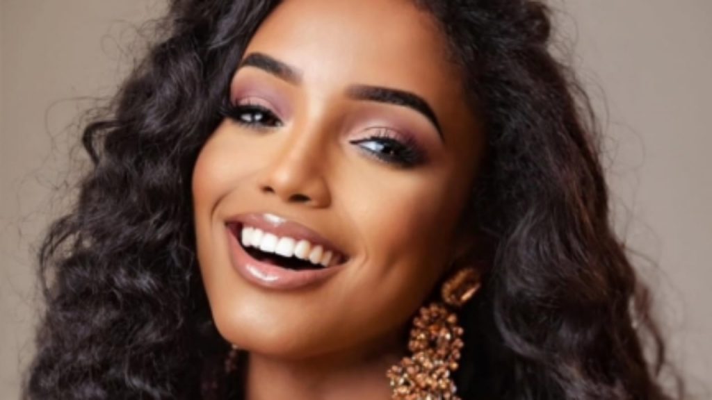 Është ende në spital/ Çfarë po ndodh me Miss Xhamajkën pasi u rrëzua nga skena